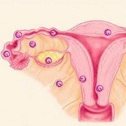 Что надо знать о такой патологии, как внематочная беременность