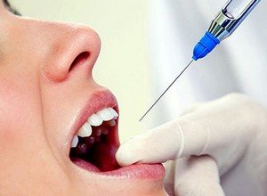 Обезболивание зубов