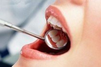 Распространенные болезни зубов