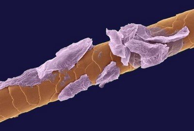 Волос в перхоти под микроскопом
