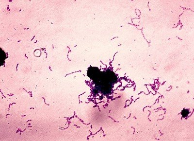 Streptococcus mutans - микроорганизм с выраженными кариесогенными свойствами