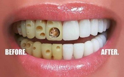 Как проводится коррекция зубов