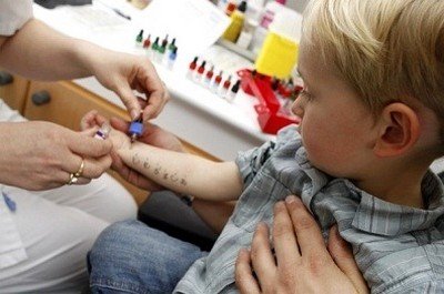 Проведение скарификационной пробы для определения аллергенов у ребенка