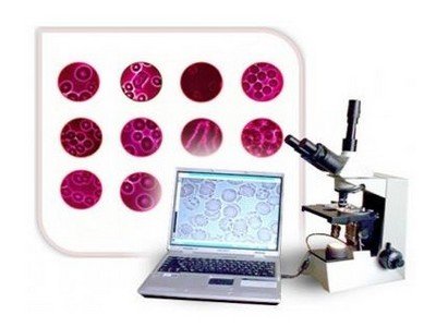 Гемосканирование - современная альтернатива классическому анализу крови