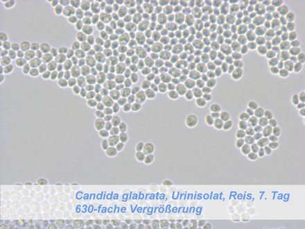 Микропрепарат Candida glabrata
