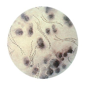 Hämophilus ducreyi - возбудитель мягкого шанкра