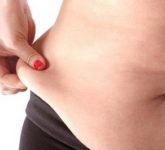 Способы избавления от обвисшей кожи после похудения