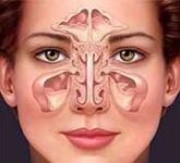 Лечим гайморит за 3 дня