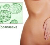 Что такое уреаплазмоз у женщин?