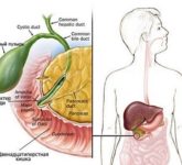Лечение и осложнения дисфункции сфинктера Одди