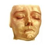 Полуатрофия лица - склеродермия