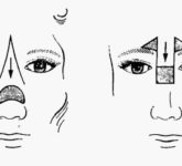 Пластическое закрытие дефектов кожи