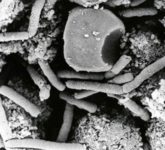Бактерии сибирской язвы - типичного зооантропоноза