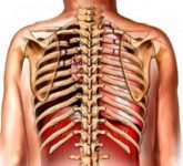 Сотрясение грудной клетки (commotio thoracis)