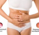 Искусственные заболевания органов