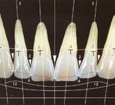 Красота (эстетика) улыбки и ее критерии