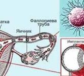 Менструация