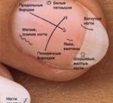 Диагноз по ногтям