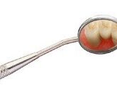 Профилактика гингивита