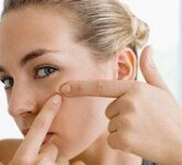 Эффективное средство от прыщей