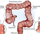 Симптомы рака толстой кишки