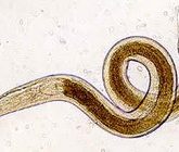 Энтеробиоз