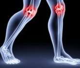 Артрит или же артроз?