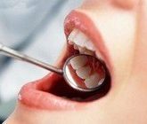 Распространенные болезни зубов