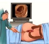 Колоноскопия является важным оружием врачей-колопроктологов