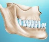 Последствия неправильного прикуса